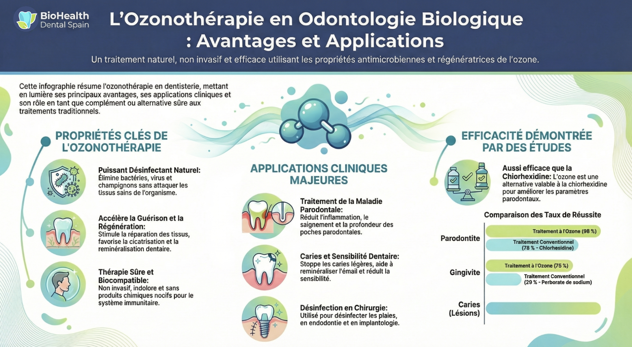 Infographie complète sur l’ozonothérapie dentaire